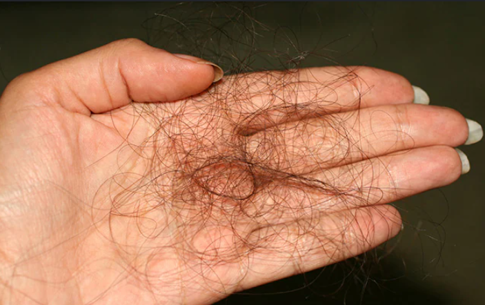 Pure Ayurvedic Power — SnehVeda Bhringraj Hair Care Benefits