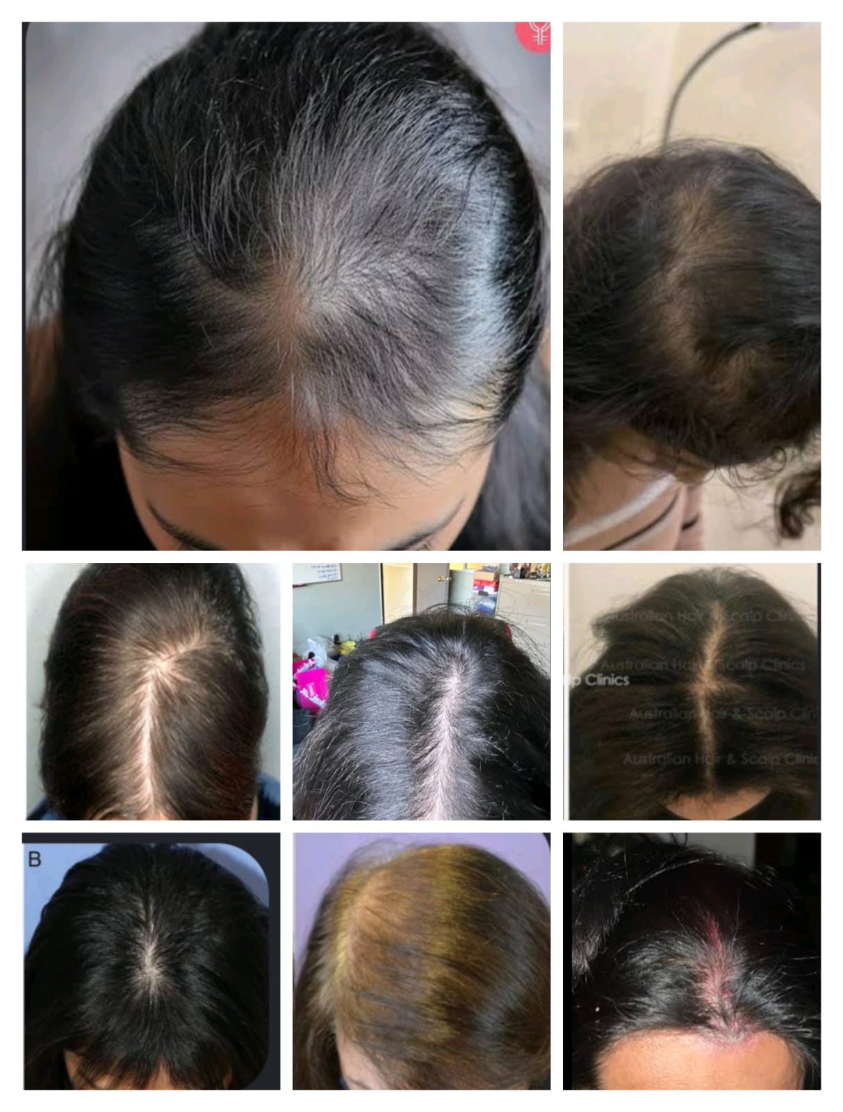 Pure Ayurvedic Power — SnehVeda Bhringraj Hair Care Benefits